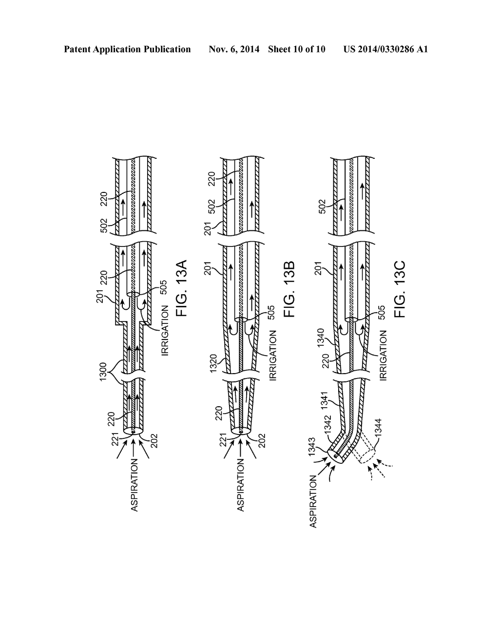 Methods and Devices for Removing Obstructing Material From the Human Body - diagram, schematic, and image 11