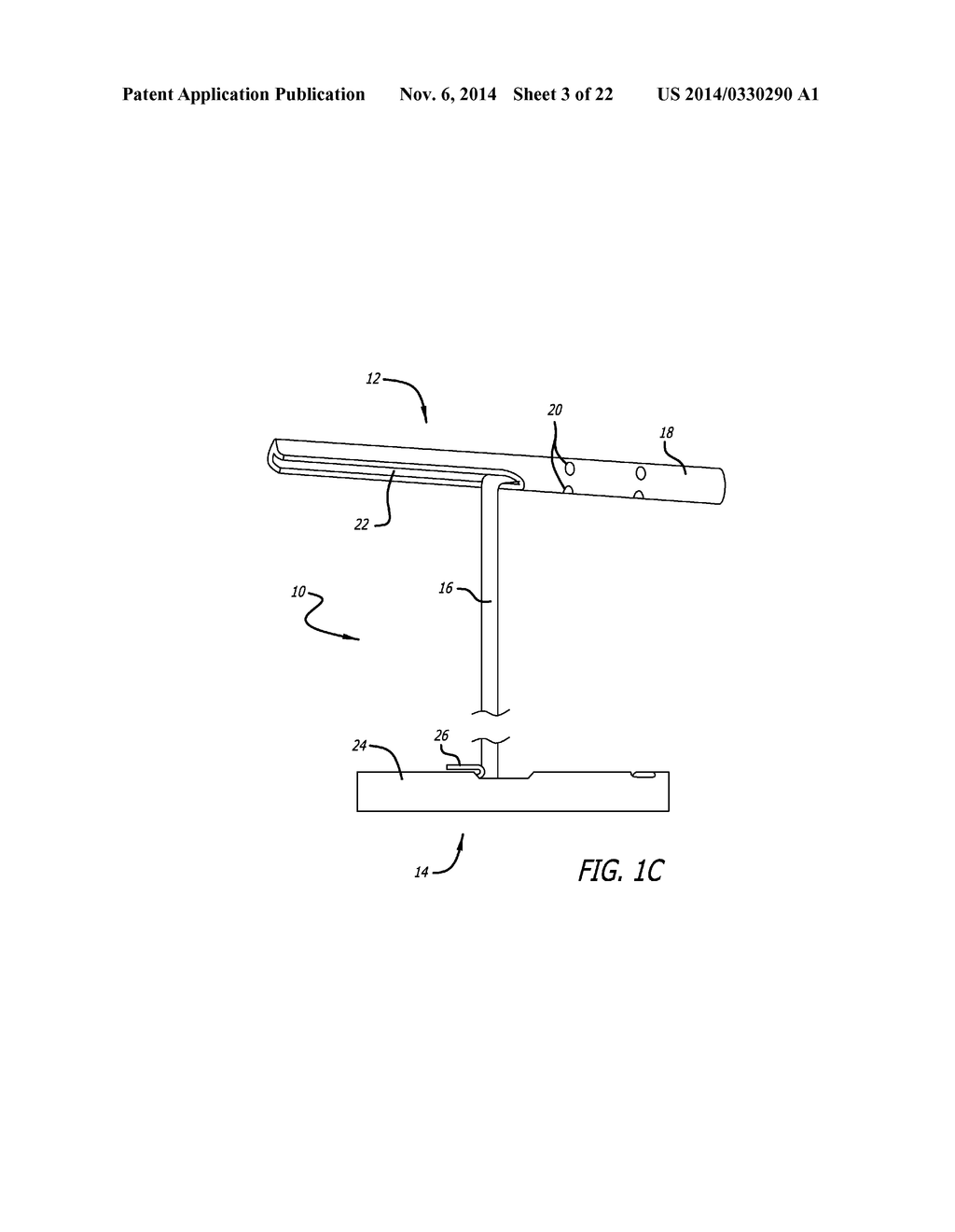 System for Delivering an Anchor - diagram, schematic, and image 04