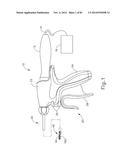 CLAMP ARM FEATURES FOR ULTRASONIC SURGICAL INSTRUMENT diagram and image