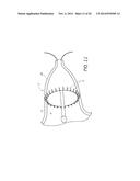 SYSTEMS AND METHODS FOR TREATING FISTULAS IN THE LUNG AND TRACHEA diagram and image