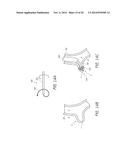 SYSTEMS AND METHODS FOR TREATING FISTULAS IN THE LUNG AND TRACHEA diagram and image