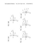 SYSTEMS AND METHODS FOR TREATING FISTULAS IN THE LUNG AND TRACHEA diagram and image