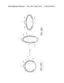 SYSTEMS AND METHODS FOR TREATING FISTULAS IN THE LUNG AND TRACHEA diagram and image