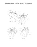 METHOD OF STABILIZING A FRACTURE AT A METAPHYSIS DEFINING A CONCAVE     ARTICULAR SURFACE diagram and image