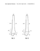 COMBINATION HOLDER/IMPACTOR AND BONE PLATE FOR FRACTURE FIXATION diagram and image