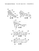 COMBINATION HOLDER/IMPACTOR AND BONE PLATE FOR FRACTURE FIXATION diagram and image