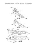 COMBINATION HOLDER/IMPACTOR AND BONE PLATE FOR FRACTURE FIXATION diagram and image