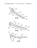 COMBINATION HOLDER/IMPACTOR AND BONE PLATE FOR FRACTURE FIXATION diagram and image