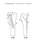 COMBINATION HOLDER/IMPACTOR AND BONE PLATE FOR FRACTURE FIXATION diagram and image