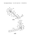 COMBINATION HOLDER/IMPACTOR AND BONE PLATE FOR FRACTURE FIXATION diagram and image