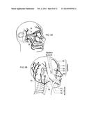 MOBILE PHONE FOR STIMULATING THE TRIGEMINAL NERVE TO TREAT DISORDERS diagram and image