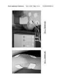 SMART PHONE APPLICATION FOR PROVIDING NEURO/MUSCULAR ELECTRO STIMULATION diagram and image