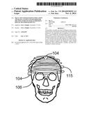 SKULL-FOCUSED RF-BASED STIMULATION APPARATUS, SYSTEM AND METHOD FOR     TREATING PATIENTS WITH ALZHEIMER S DISEASE OR OTHER DEMENTIA diagram and image