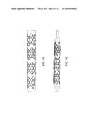 SEGMENTED SCAFFOLD DESIGNS diagram and image