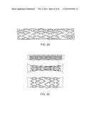 SEGMENTED SCAFFOLD DESIGNS diagram and image