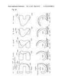 ARTIFICIAL KNEE JOINT IMPLANT diagram and image