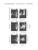 System and Method for Damage Diagnosis diagram and image