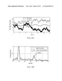 RANDOM BODY MOVEMENT CANCELLATION FOR NON-CONTACT VITAL SIGN DETECTION diagram and image