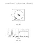 RANDOM BODY MOVEMENT CANCELLATION FOR NON-CONTACT VITAL SIGN DETECTION diagram and image