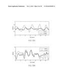 RANDOM BODY MOVEMENT CANCELLATION FOR NON-CONTACT VITAL SIGN DETECTION diagram and image