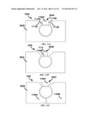 Transversal Cleaning Apparatus diagram and image