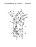 ORAL SLEEP APNOEA DEVICE diagram and image