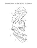 ORAL SLEEP APNOEA DEVICE diagram and image