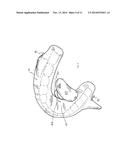 ORAL SLEEP APNOEA DEVICE diagram and image