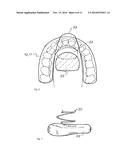 ORAL SLEEP APNOEA DEVICE diagram and image