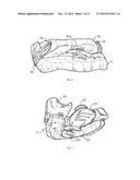 ORAL SLEEP APNOEA DEVICE diagram and image