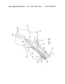 Vented Pour Spout diagram and image