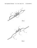 D-SHAPED SURGICAL STAPLES diagram and image