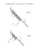 D-SHAPED SURGICAL STAPLES diagram and image