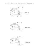 D-SHAPED SURGICAL STAPLES diagram and image