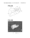 PATTERN AND SURGERY SUPPORT SET, APPARATUS, METHOD AND PROGRAM diagram and image