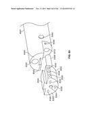 Operational Interface in a Multi-Viewing Element Endoscope diagram and image