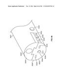 Operational Interface in a Multi-Viewing Element Endoscope diagram and image