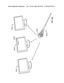 Operational Interface in a Multi-Viewing Element Endoscope diagram and image