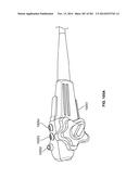 Operational Interface in a Multi-Viewing Element Endoscope diagram and image