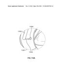 Operational Interface in a Multi-Viewing Element Endoscope diagram and image