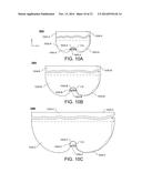 LIGHT-EMITTING DEVICE WITH TOTAL INTERNAL REFLECTION (TIR) EXTRACTOR diagram and image