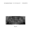 X-RAY IMAGING APPARATUS diagram and image