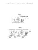 IMAGE PROCESSING APPARATUS AND X-RAY CT APPARATUS diagram and image