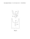 LIQUID DISPENSING APPLICATOR WITH RADIAL LOCKING SYSTEM diagram and image