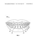 ORAL ILLUMINATION SYSTEMS AND METHODS diagram and image