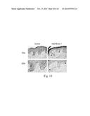 HUMAN SKIN SAMPLE METHODS AND MODELS FOR VALIDATING HYPOTHESES FOR     MECHANISMS DRIVING SKIN PIGMENTATION diagram and image