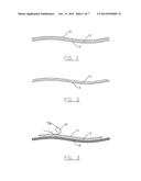 LAUNDRY STAIN AND SOIL PRETREATMENT DEVICES diagram and image