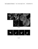 POLYPEPTIDES TARGETING GLYCOSYLATED MUC2 PROTEINS, METHODS OF SYNTHESIS,     THEIR NUCLEIC ACIDS AND USES THEREOF diagram and image