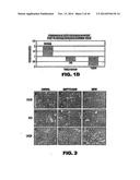 TARGETING EN2, PAX2, AND/OR DEFB1 FOR TREATMENT OF PROSTATE CONDITIONS diagram and image