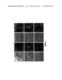 TARGETING EN2, PAX2, AND/OR DEFB1 FOR TREATMENT OF PROSTATE CONDITIONS diagram and image